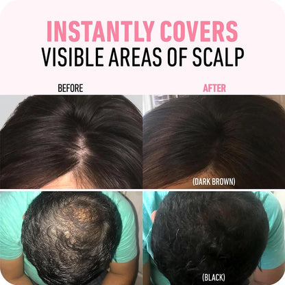 Revive Your Hairline Powder™